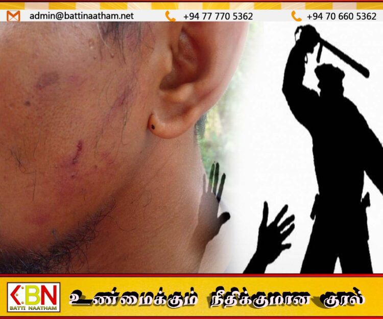 சந்தேகத்தின் பேரில் அழைத்து சென்று ஈவிரக்கமின்றி தாக்கிய பொலிஸார்