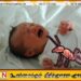 யாழில் எறும்பு கடித்து பச்சிளம் குழந்தை மரணம்