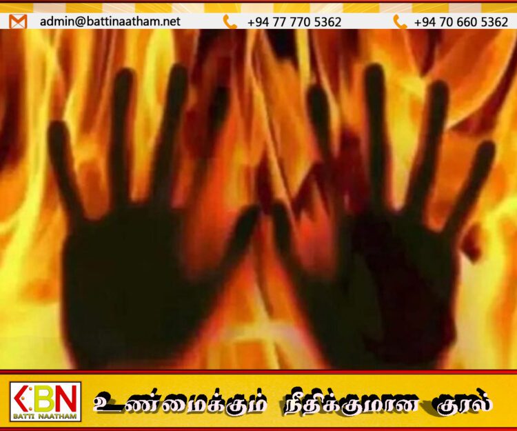 கொட்டாவை பகுதியில் வீட்டில் ஏற்பட்ட தீ விபத்தில் 19 வயது இளம் பெண் உயிரிழப்பு
