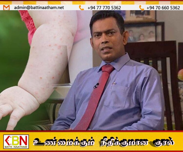 டெங்கு மற்றும் சிக்குன்குனியாவால் பாதிக்கப்படும் குழந்தைகளின் எண்ணிக்கை அதிகரிப்பு
