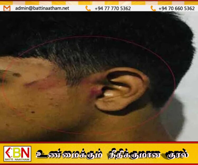 உயர்தர வகுப்பு மாணவனின் முகத்தில் பலமுறை தாக்கிய ஆசிரியர்; பொலிஸார் விசாரணை