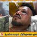 இந்திய விமான விபத்தில் ஒருவரை தவிர அனைவரும் உயிரிழப்பு