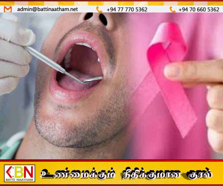 இலங்கையில் வேகமாக பரவிவரும் வாய்ப் புற்று நோய்; நிபுணர்கள் எச்சரிக்கை