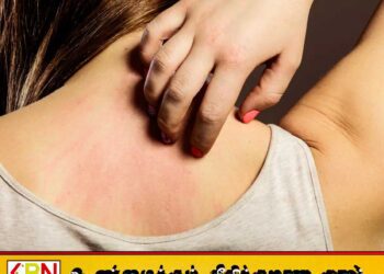 நாடு முழுவதும் தோல் தொடர்பான நோய்கள் அதிகரிப்பு