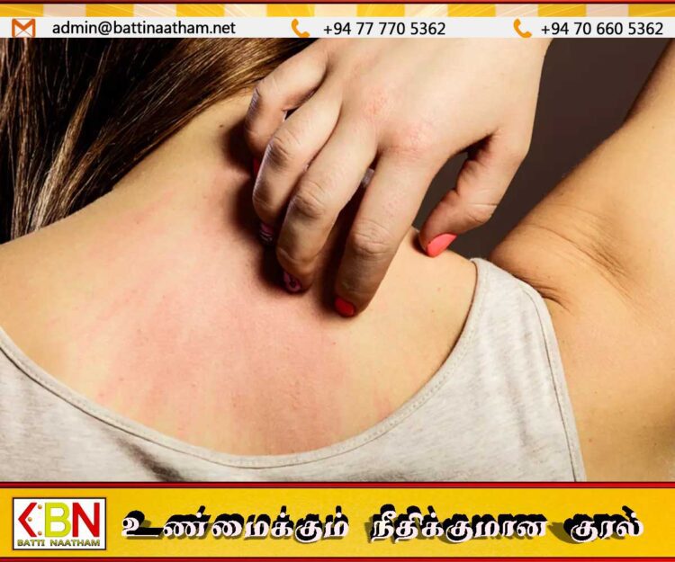 நாடு முழுவதும் தோல் தொடர்பான நோய்கள் அதிகரிப்பு