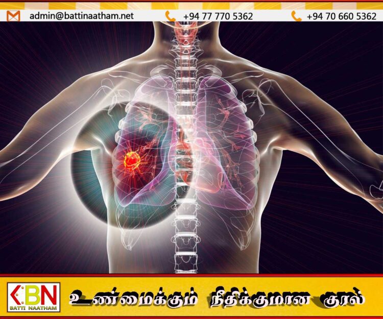 பெண்களை விட ஆண்களுக்கு நுரையீரல் புற்றுநோய் ஏற்படும் அபாயம்