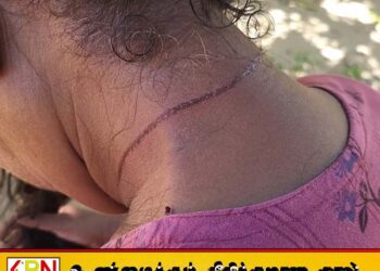மட்டு ஊறணியில் வயோதிப பெண்ணின் கழுத்தில் கத்தி வைத்து தாலி திருட்டு