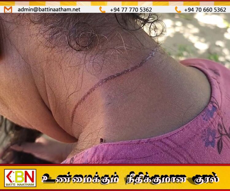 மட்டு ஊறணியில் வயோதிப பெண்ணின் கழுத்தில் கத்தி வைத்து தாலி திருட்டு