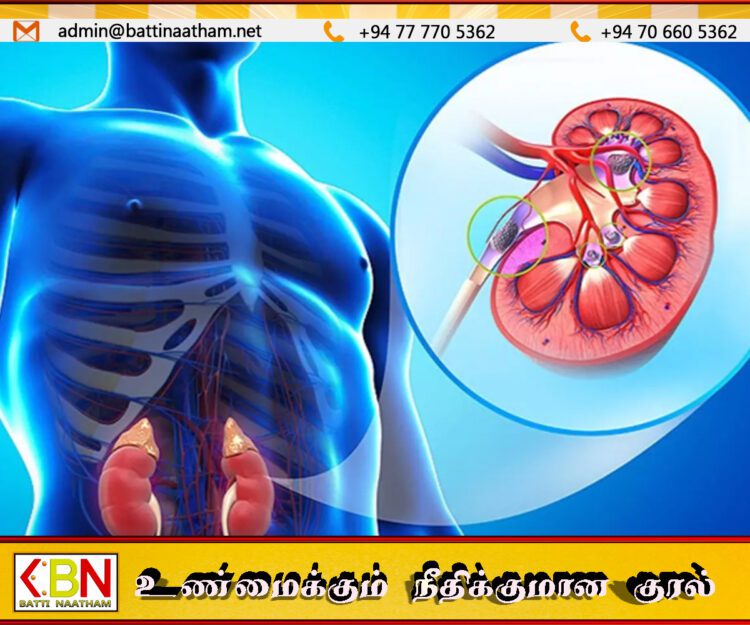 நாள்தோறும் ஐந்து உயிர்களை காவுகொள்ளும் சிறுநீரக நோய்; தேசிய பிரிவு எச்சரிக்கை