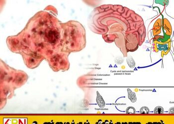 இந்தியாவில் ‘மூளையை உண்ணும்’ அமீபா தோற்று அதிகரிப்பு