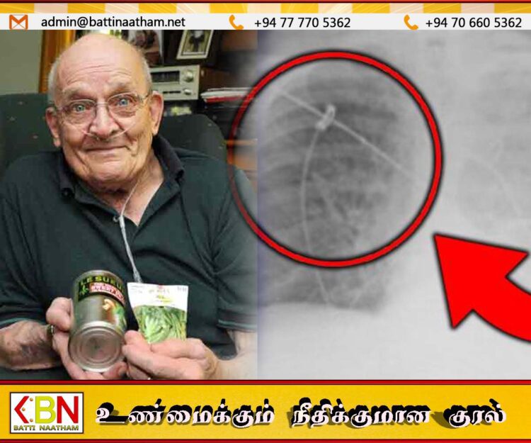 அமெரிக்க நபரின் நுரையீரலுக்குள் வளர்ந்த பட்டாணிச் செடி