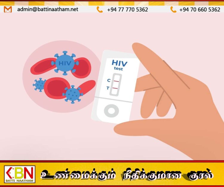 இலங்கையில் எச்.ஐ.வி தொற்று அதிகரித்து வருவதாக தகவல்