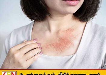 கர்ப்பிணித் தாய்மார்களுக்கு தோல் வைத்திய நிபுணரின் அறிவுறுத்தல்
