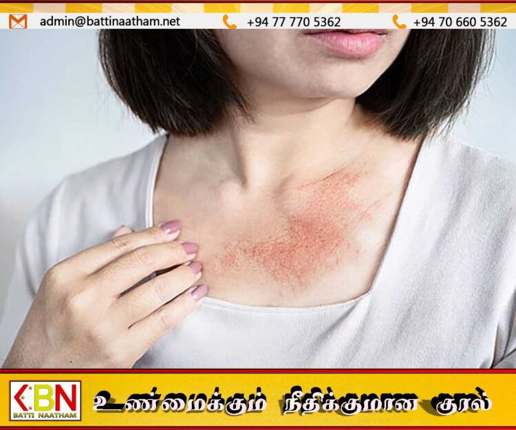 கர்ப்பிணித் தாய்மார்களுக்கு தோல் வைத்திய நிபுணரின் அறிவுறுத்தல்