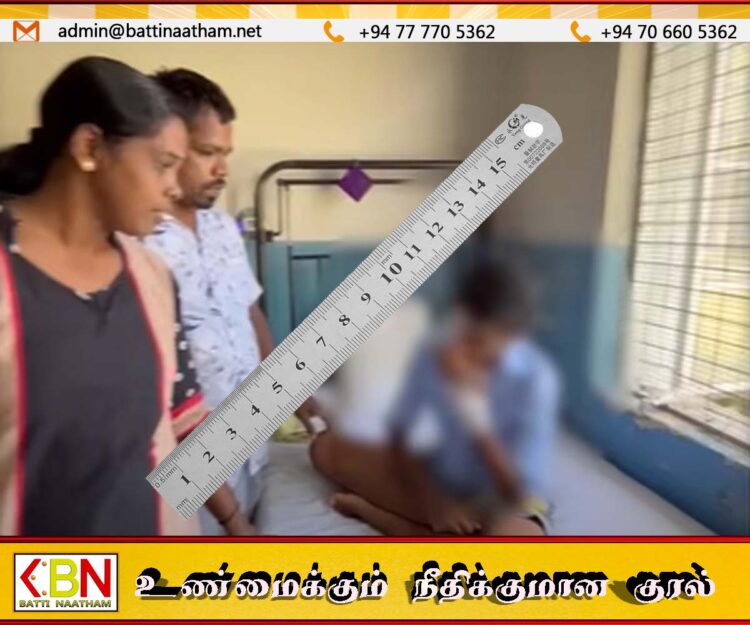 பிழையாக பதில் கூறிய மாணவன்- ஆசிரியை அலுமினிய அடிமட்டதால் எரிந்ததால் மாணவனின் கண்பார்வை கேள்விக்குறி:கொழும்பில் சம்பவம்