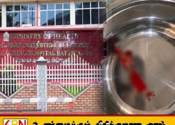 மட்டக்களப்பு போதனா வைத்தியசாலையில் வரலாற்று சாதனை: கிழக்கு மாகாணத்தில் முதல் கரோடிட் எண்டார்டெரெக்டோமி சத்திரசிகிச்சை வெற்றிகரமாக நிறைவு