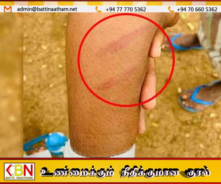 பாடசாலைக்கு வராத காரணத்தால் 7 வயது மாணவியை மரக் குச்சியால் தாக்கிய அதிபர் மீது விசாரணை