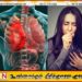 காசநோயினால் 1.23 மில்லியன் மக்கள் உயிரிழப்பு – உலக சுகாதார அமைப்பு