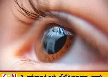 இலங்கையில் அதிகரிக்கும் “கெரடோகோனஸ்” கண் நோய்; பாடசாலை மாணவர்கள் உட்பட இலங்கை மக்களுக்கு எச்சரிக்கை