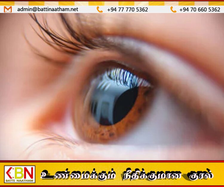 இலங்கையில் அதிகரிக்கும் “கெரடோகோனஸ்” கண் நோய்; பாடசாலை மாணவர்கள் உட்பட இலங்கை மக்களுக்கு எச்சரிக்கை