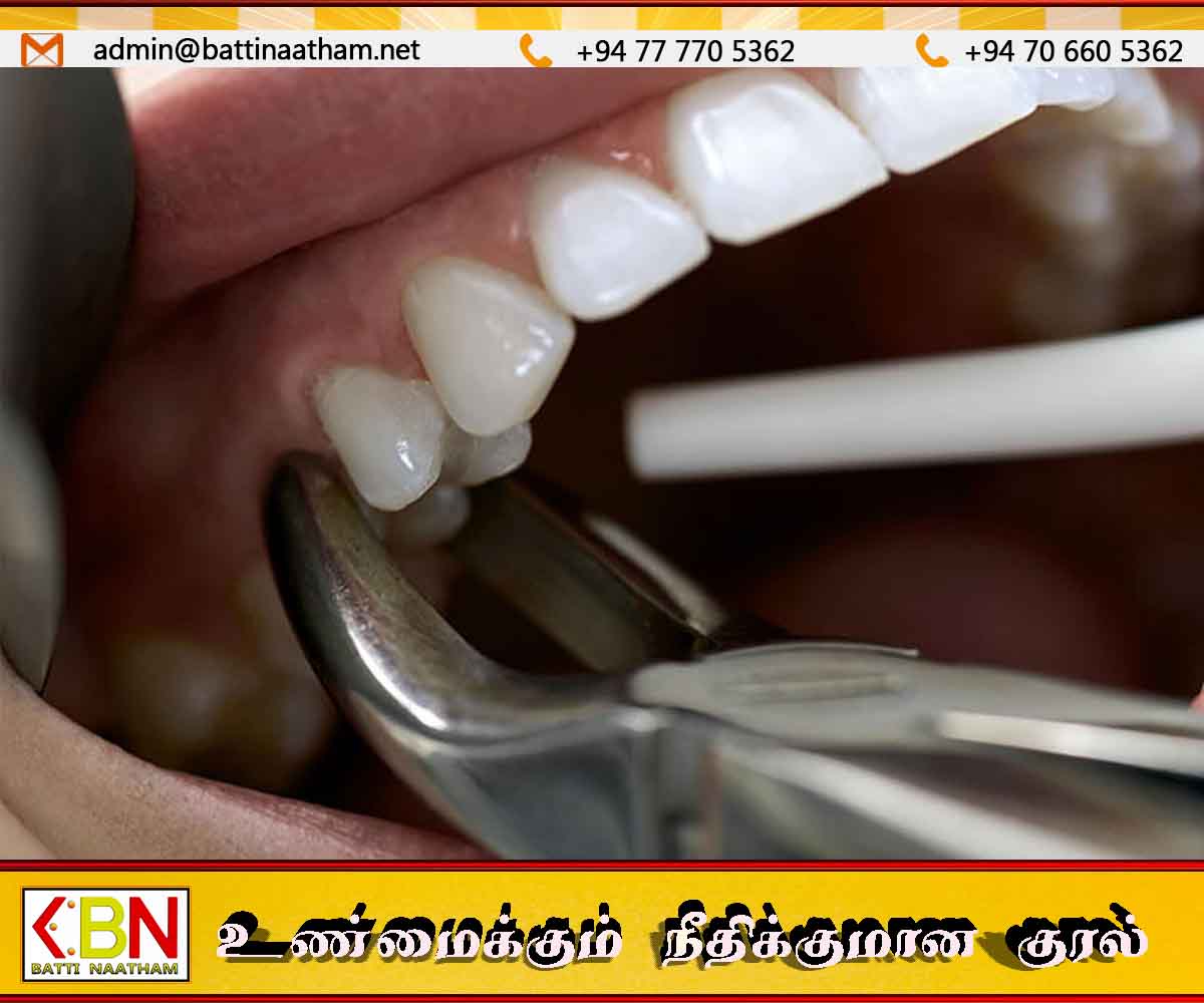 ஹொரணை பகுதியில் பல் பிடுங்கிய 20 வயது யுவதி மரணம்