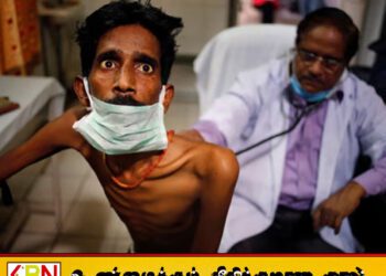 இலங்கையில் வருடாந்தம் 9,500 வரை காசநோயாளிகள் அடையாளம்!