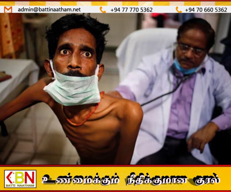 இலங்கையில் வருடாந்தம் 9,500 வரை காசநோயாளிகள் அடையாளம்!