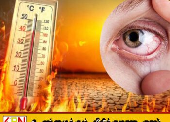 வெப்ப நிலையால் கண் தொடர்பான பிரச்சனைகள் ஏற்படும்; வைத்தியர் மலரவன் எச்சரிக்கை!