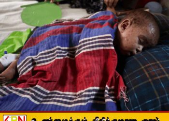 பங்களாதேஷில் தட்டம்மை நோய்; 259 பேர் உயிரிழப்பு!