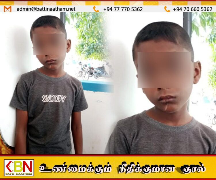 மட்டு முறக்கொட்டான்சேனையில் 8 வயது மகனுக்கு வாயில் சூடு வைத்த தந்தை கைது