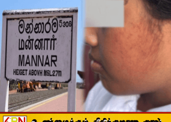 5ஆம் வகுப்பு மாணவியை கொடூரமாக அறைந்த ஆசிரியை; சிறுமி வைத்தியசாலையில் அனுமதி!