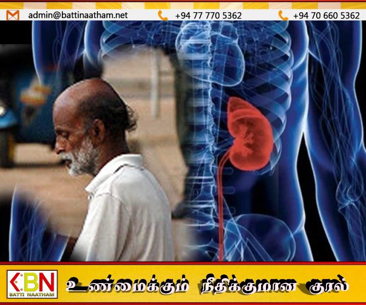 சிறுநீரக நோயின் அச்சுறுத்தல் அதிகரிப்பு; இலங்கை முதியோரில் 10% பேர் பாதிப்பு