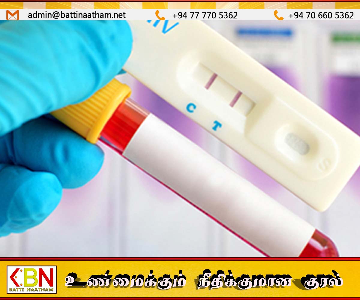 இலங்கையில் எச்.ஐ.வி. தொற்று அதிகரிக்க பாதுகாப்பற்ற உடலுறவே முக்கிய காரணம்!