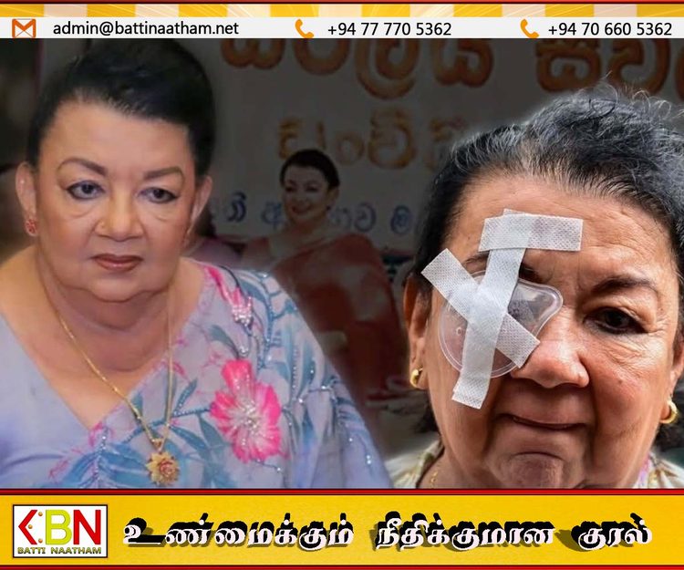 நாளை கொழும்பு தேசிய கண் மருத்துவமனைக்கு செல்கிறார் ஷிரந்தி ராஜபக்ச